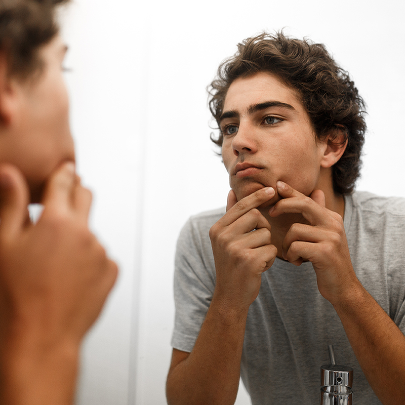 adolescente con granos frente al espejo