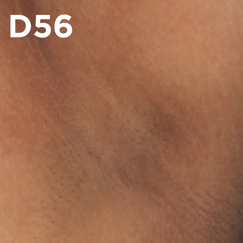 Clínicamente probado y aprobado en manchas oscuras