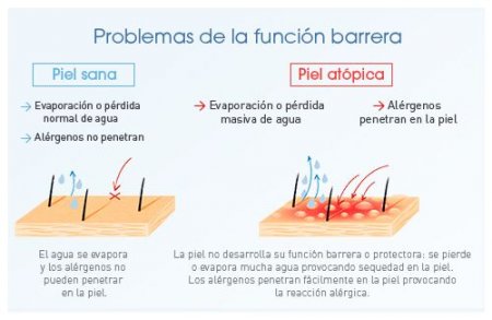 Esquema problema de la barrera cutánea