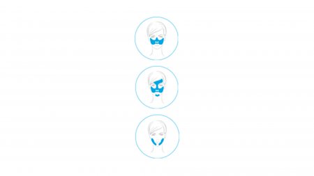 BIODERMA melasma piel hiperpigmentación