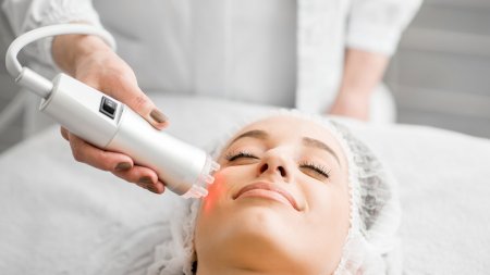 Tratamiento con Láser contra la melanina y las manchas en la cara