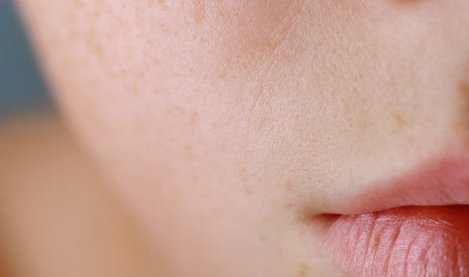 Gran engaño marrón Favor Cómo se diferencia una piel seca y una piel deshidratada? | Atoderm |  BIODERMA