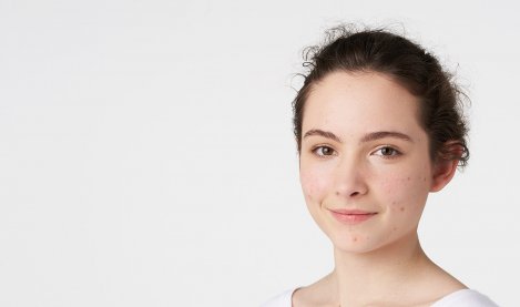 BIODERMA - piel con acné en adolescentes
