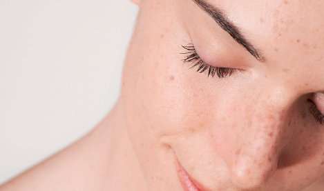 Skin barrier role