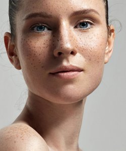 crema para piel con manchas BIODERMA 